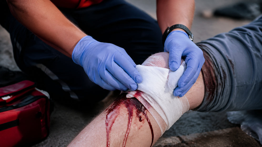 How to Stop Severe Bleeding: A Step-by-Step Guide