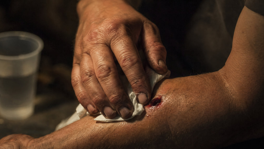 How to Treat a Puncture Wound Before Help Arrives