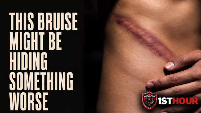 Internal Bleeding Symptoms After Blunt Trauma: What to Watch