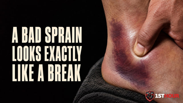 Sprained Ankle vs Broken Ankle: How to Tell at Home
